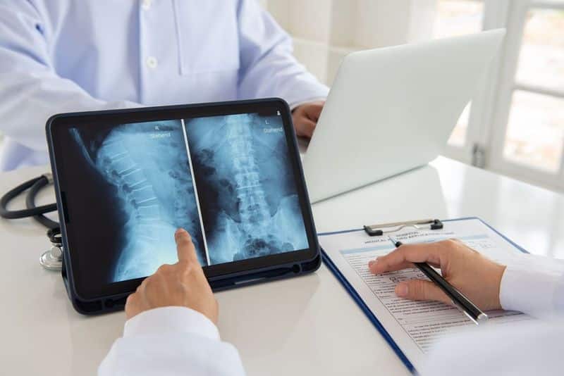 Beverly Hills Spinal Cord Injury Attorney